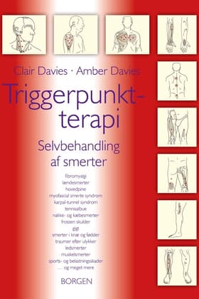 Triggerpunktterapi af Clair Davies