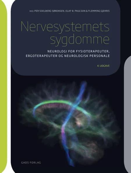 Nervesystemets sygdomme af Flemming Gjerris