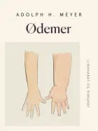 Ødemer
