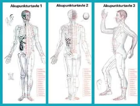 Akupunktur planche - Krop 1-3 