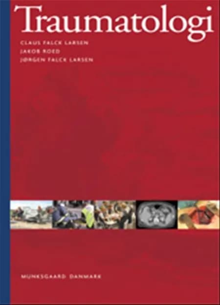 Traumatologi af Jørgen Falck Larsen