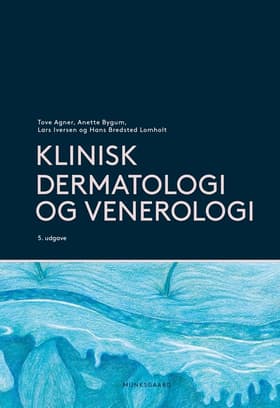 Klinisk dermatologi og venerologi af Klaus Ejner Andersen