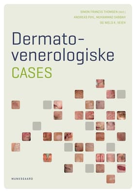 Dermato- venerologiske cases af Andreas Pihl