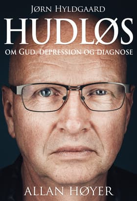 Hudløs af Allan Høyer