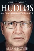 Hudløs af Allan Høyer