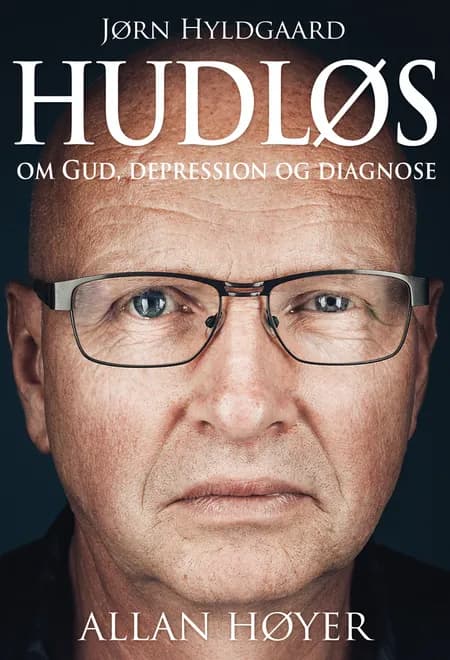 Hudløs af Allan Høyer