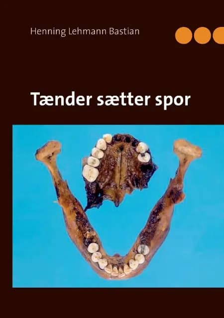 Tænder sætter spor af Henning Lehmann Bastian