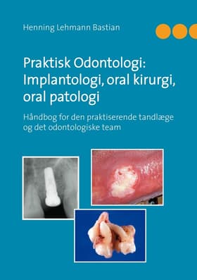 Praktisk odontologi: implantologi, oral kirurgi, oral patologi af Henning Lehmann Bastian