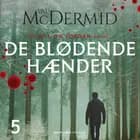 De blødende hænder af Val McDermid