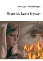 Brændt barn fryser
