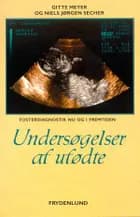 Undersøgelser af ufødte af Gitte Meyer og Niels Jørgen Secher
