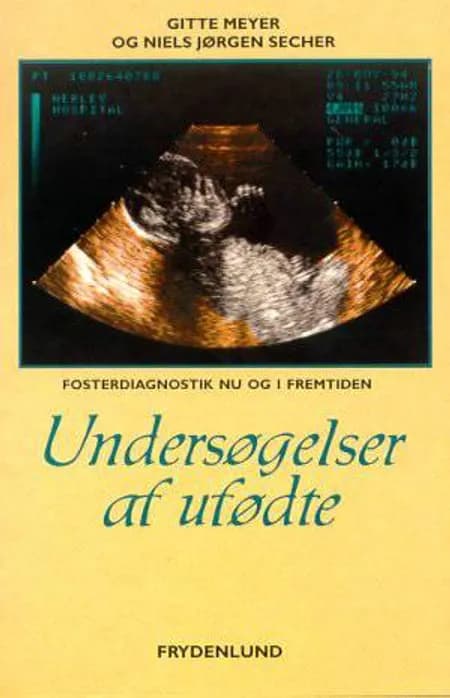 Undersøgelser af ufødte af Gitte Meyer