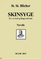 Skinsyge