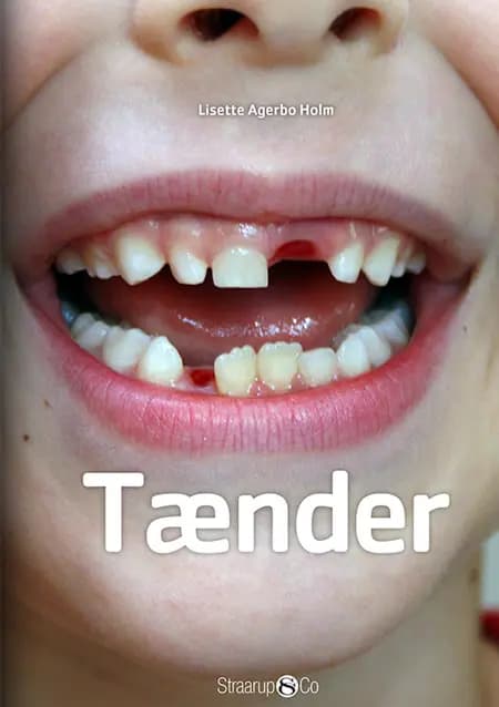 Tænder af Lisette Agerbo Holm