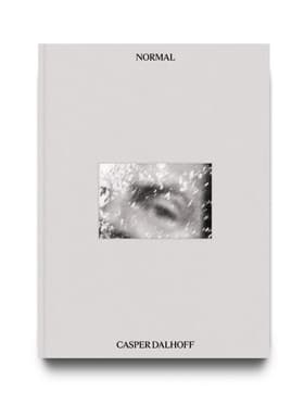 Normal af Casper Dalhoff