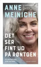Det ser fint ud på røntgen af Anne Meiniche