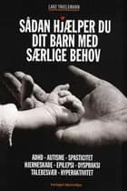 Sådan hjælper du dit barn med særlige behov