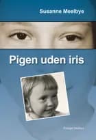 Pigen uden iris