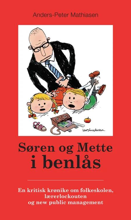 Søren og Mette i benlås af Anders-Peter Mathiasen