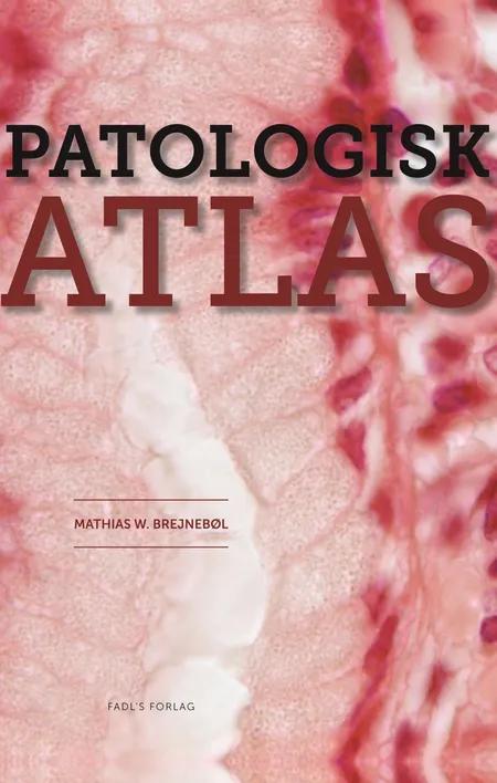Patologisk atlas af Mathias Willadsen Brejnebøl