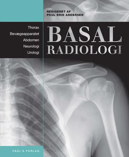 Basal radiologi af Poul Erik Andersen