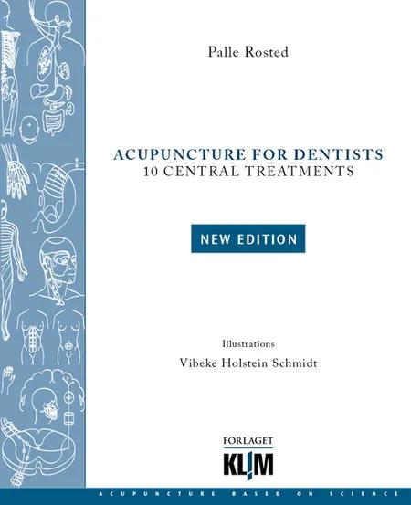 Acupuncture for dentists af Palle Rosted