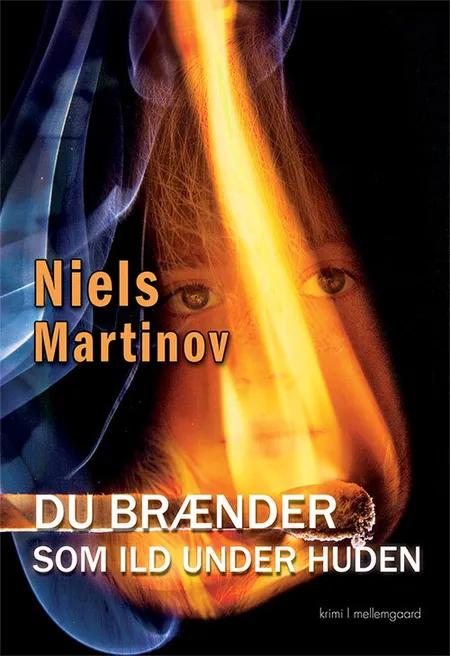 Du brænder som ild under huden af Niels Martinov
