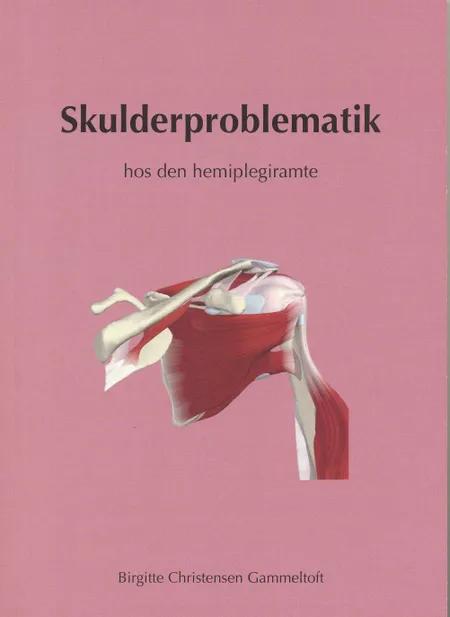 Skulderproblematik og skulderrehabilitering hos den hemiplegiramte af Birgitte Christensen Gammeltoft